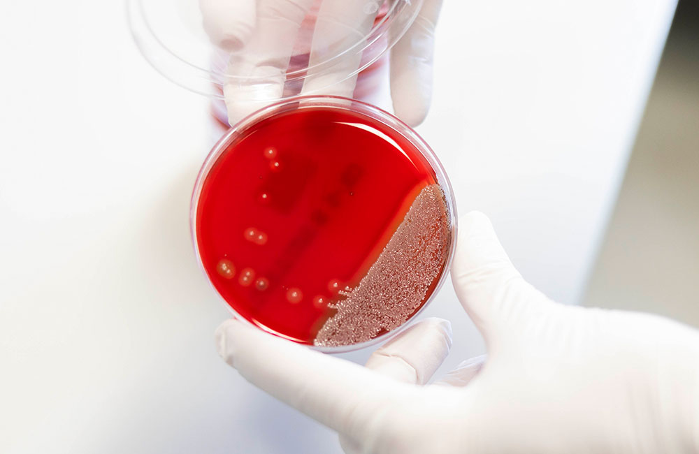 Staphylococcus aureus_Sarah Kossmann Staphylococcus aureus_Sarah Kossmann